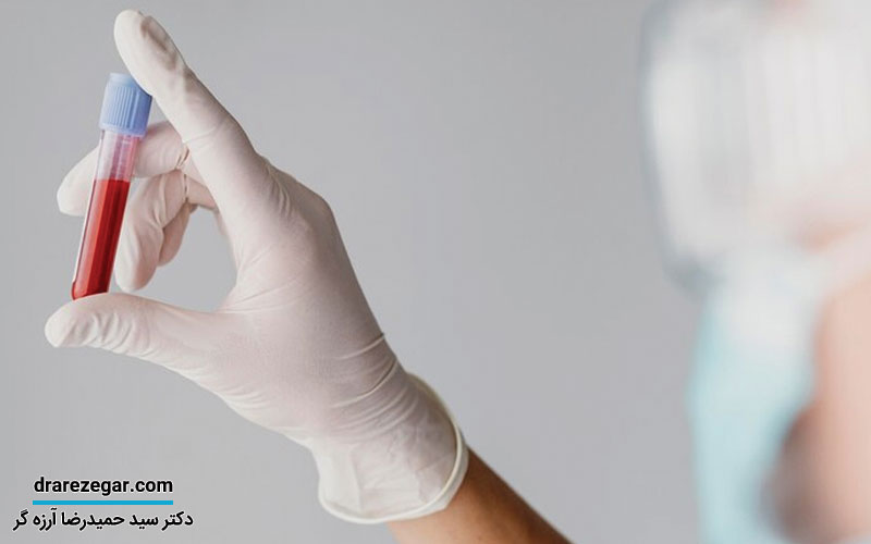 لخته خون در ادرار