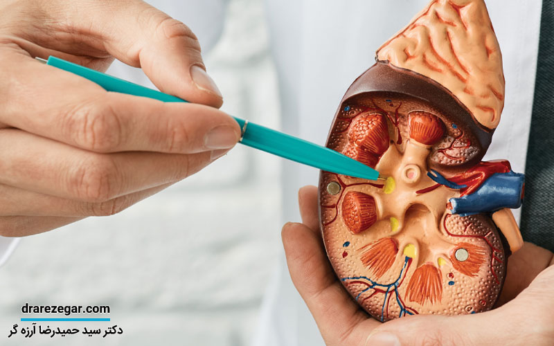 تغذیه مناسب برای پیشگیری و درمان سرطان کلیه