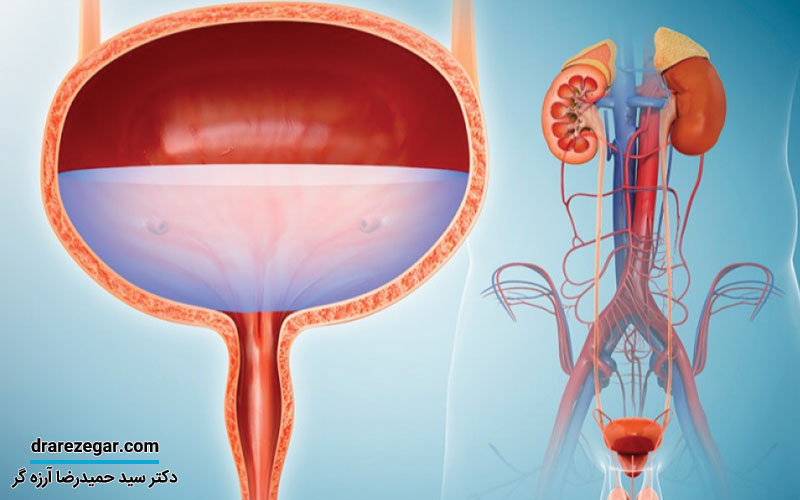 انواع اختلالات مادرزادی سیستم ادراری