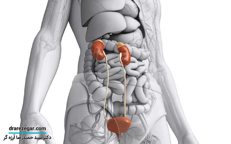 انواع اختلالات مادرزادی سیستم ادراری