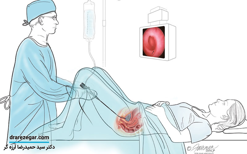 سیستوسکوپی مثانه چیست