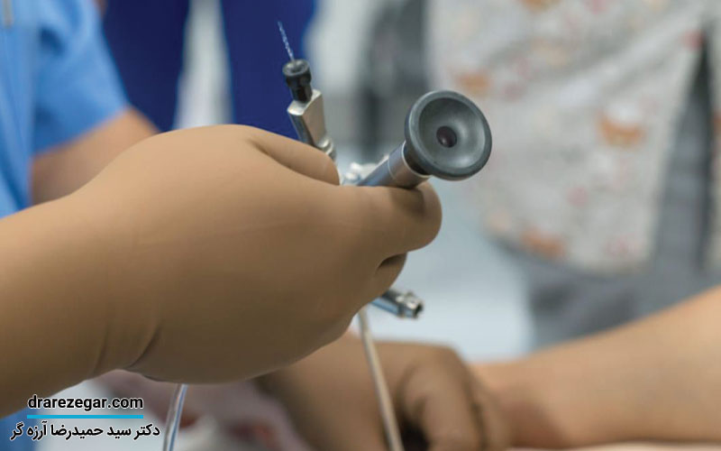 سیستوسکوپی مثانه چیست