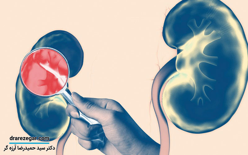نارسایی حاد و مزمن کلیه