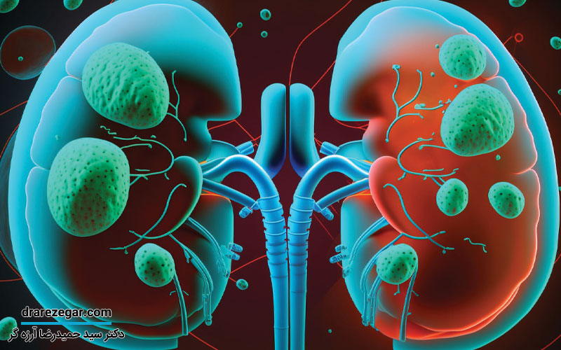 نارسایی حاد و مزمن کلیه