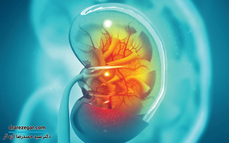 سنگ کلیه چطور درمان می شود