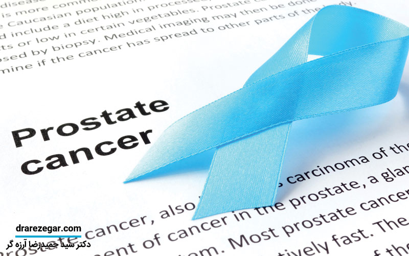 بهترین روش های درمان سرطان پروستات
