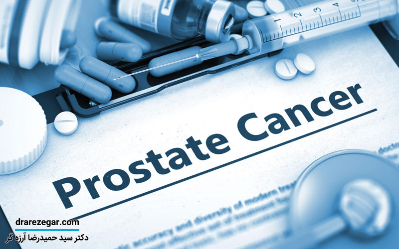 بهترین روش های درمان سرطان پروستات