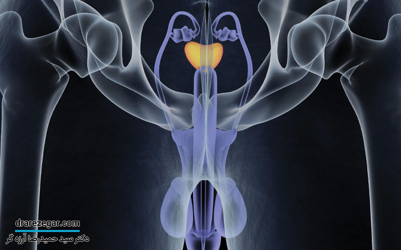 التهاب پروستات چیست