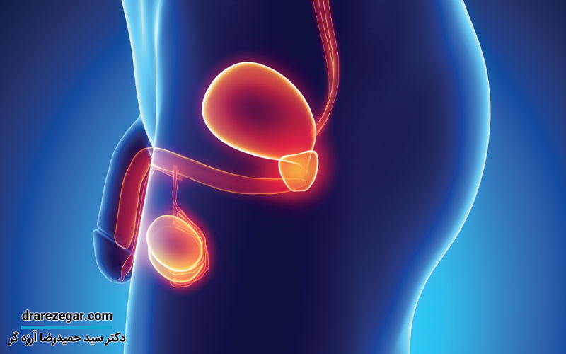 التهاب پروستات چیست