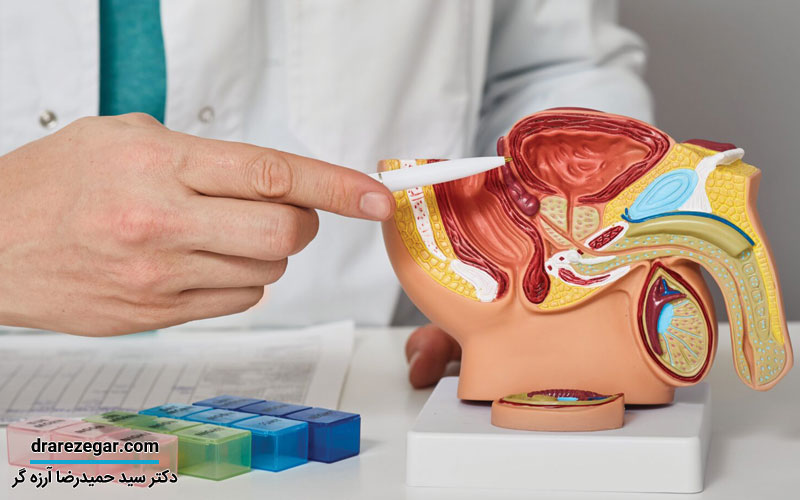 پروستات چیست