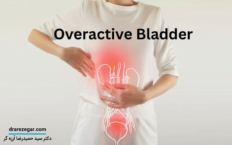 بیش فعالی مثانه چیست