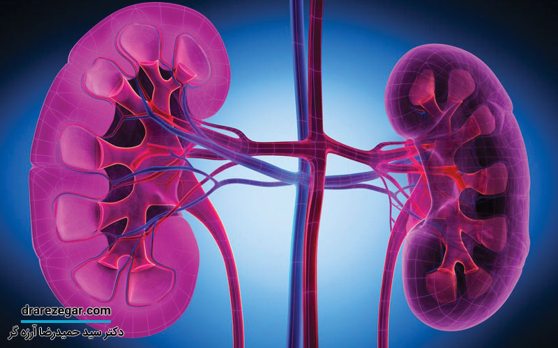 بهترین درمان ها برای نارسایی کلیه