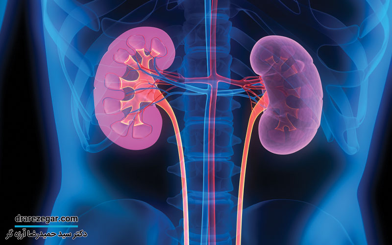 انواع درمان نارسایی کلیه