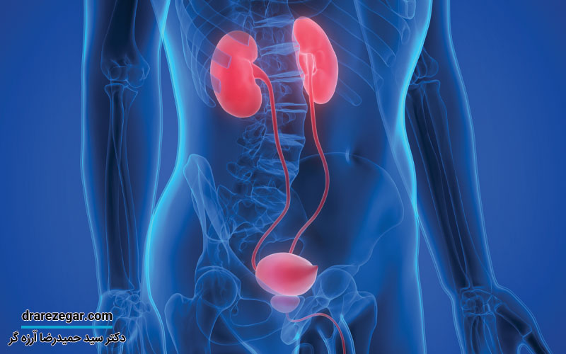 انواع بیماری های پروستات