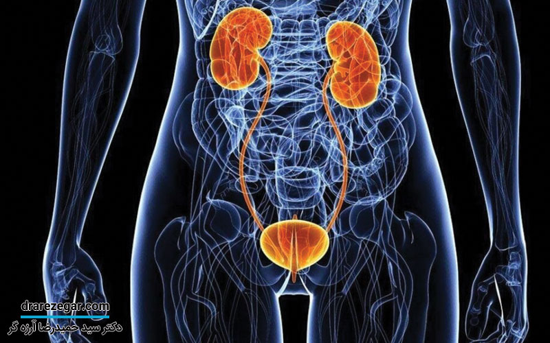 التهاب مثانه در مردان