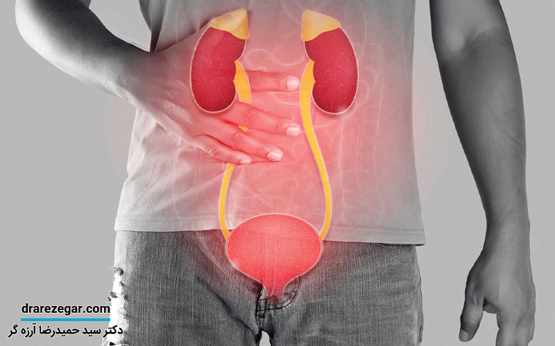 التهاب مثانه در مردان