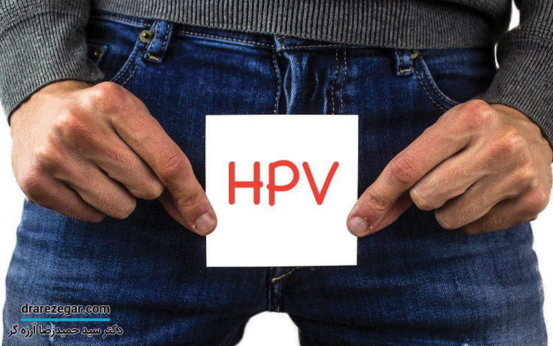 زگیل تناسلی در مردان