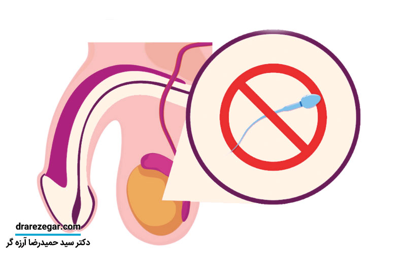 آزواسپرمی چیست