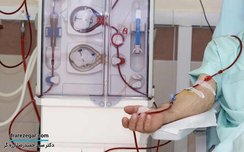 دیالیز برای چه افرادی مناسب است