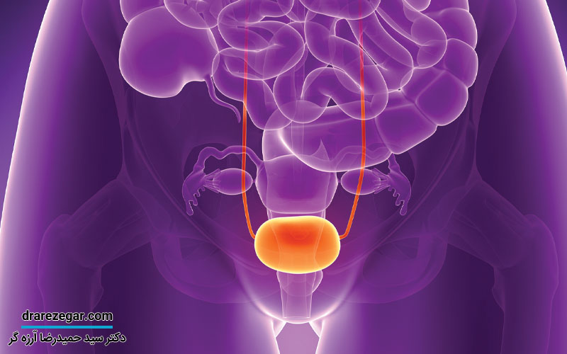 مشکلات مثانه در مردان