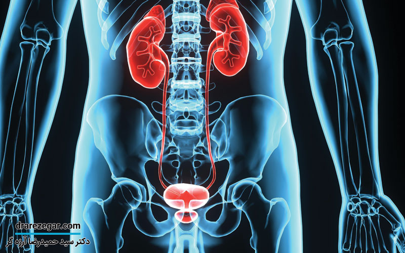 مشکلات مثانه در مردان