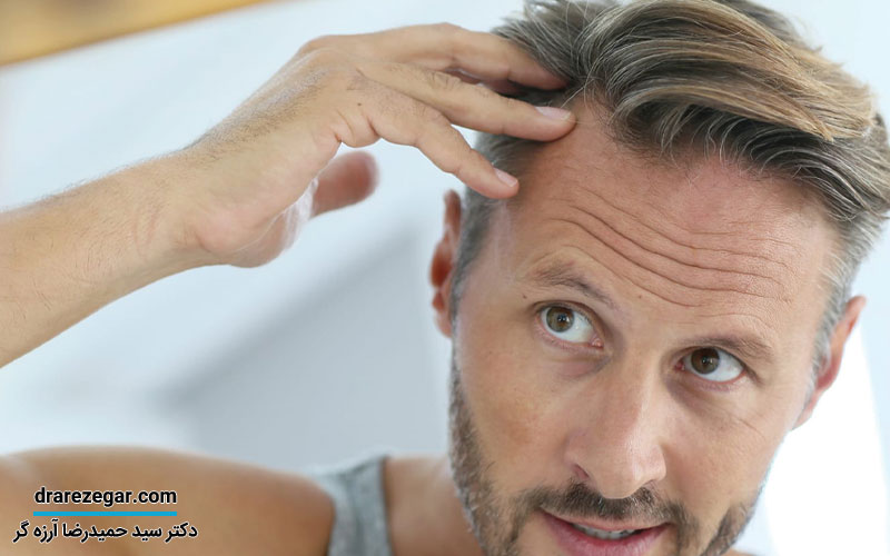 مشکلات هورمونی در مردان