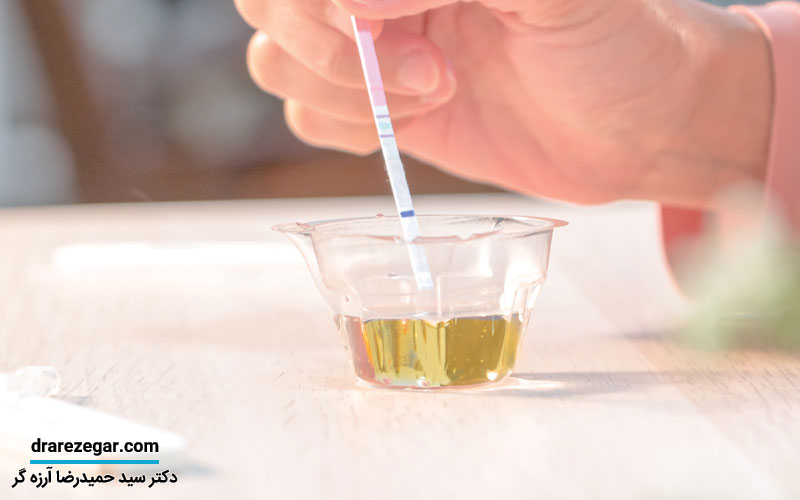 دفع پروتئین چیست