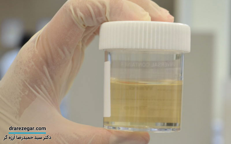 دفع پروتئین چیست