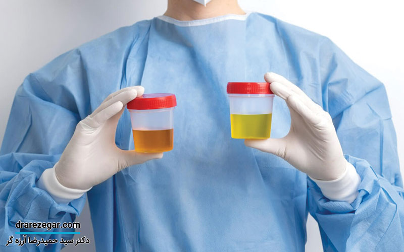 علت وجود خون در ادرار چیست