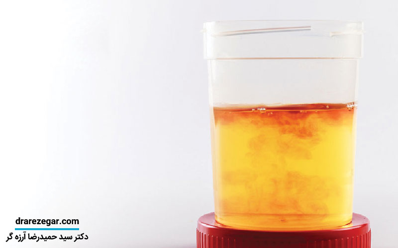 علت وجود خون در ادرار چیست