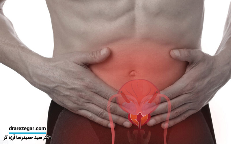 تنگی مجرای ادرار در مردان