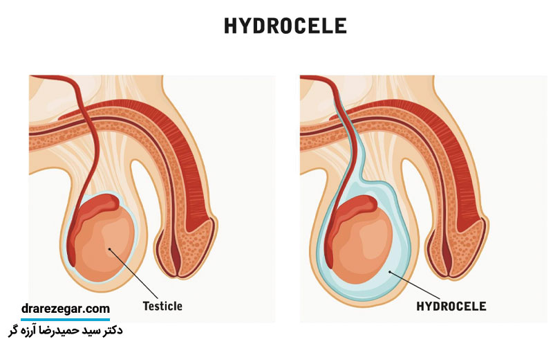 هیدروسل چیست