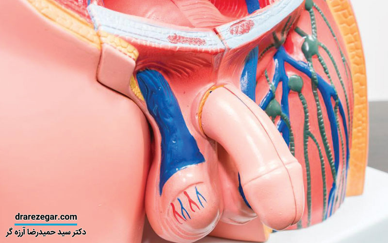 هیدروسل چیست