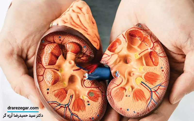 سندروم نفروتیک چیست