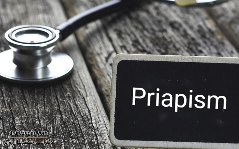 پریاپیسم چیست