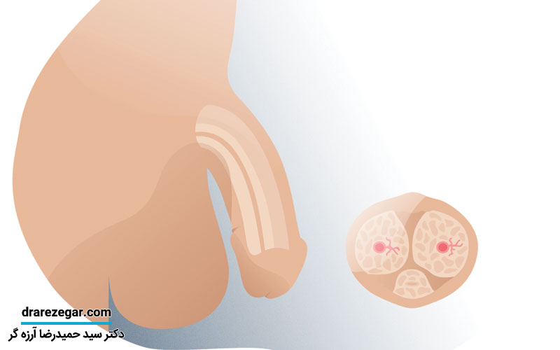 پریاپیسم چیست