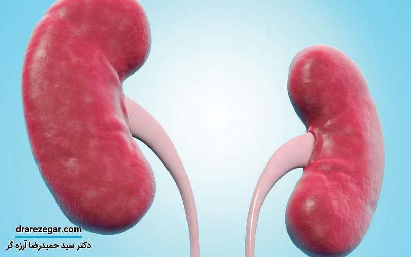 نفروپتوز کلیه چیست