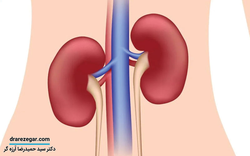 نفروپتوز کلیه چیست