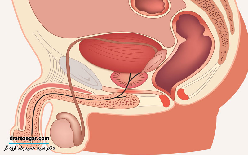 عدم نزول بیضه چیست