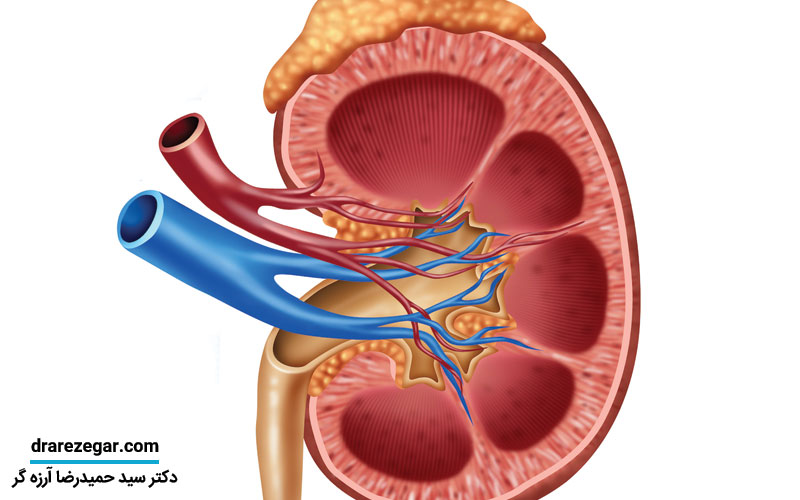 نشانه های نارسایی کلیه