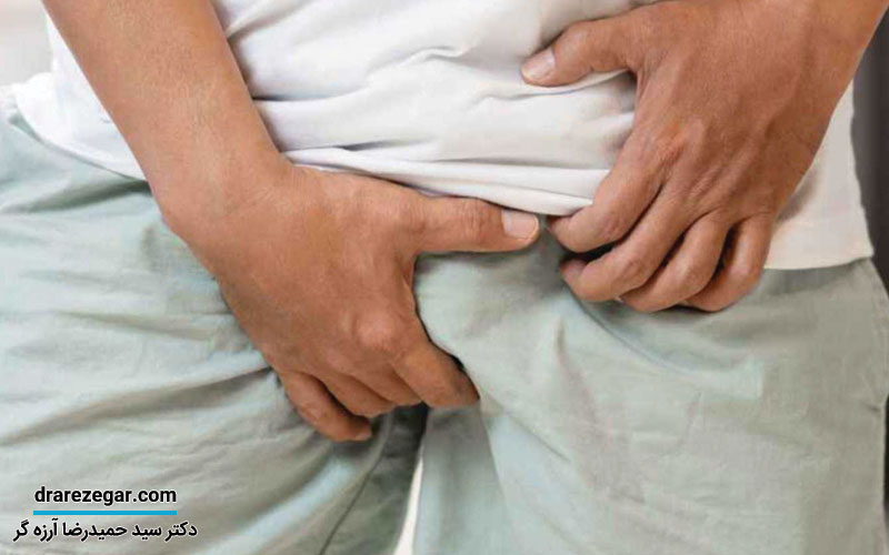 درمان ملانوز آلت تناسلی با لیزر