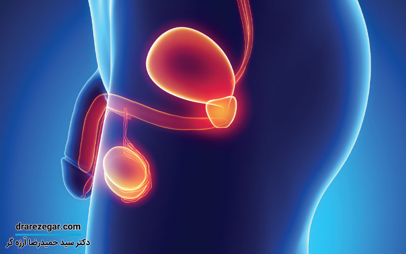 بزرگی بدخیمی پروستات