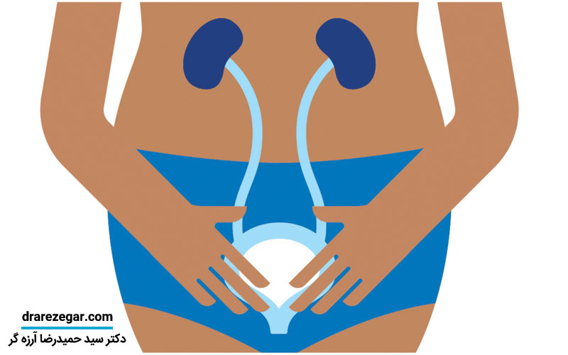 سیستوسل چیست