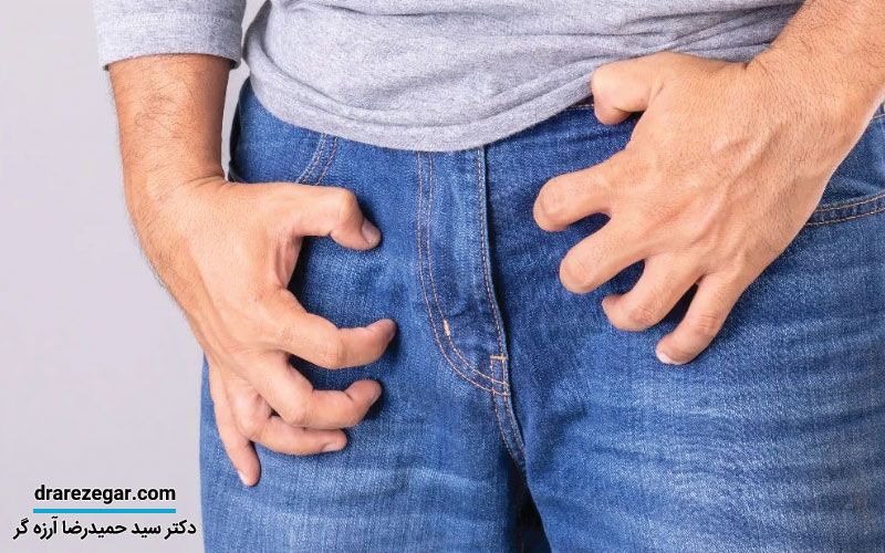 علت خارش بیضه چیست