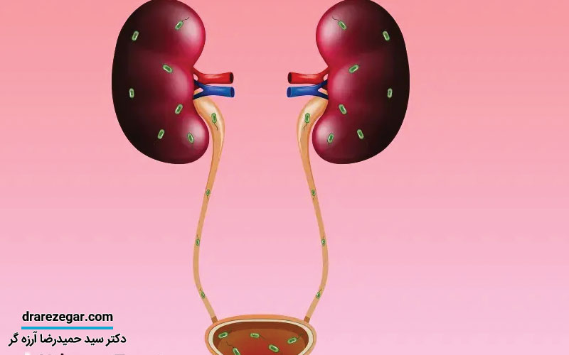 شایع ترین بیماری های کلیه و مجاری ادرار