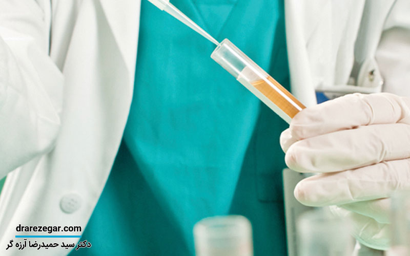 کاربرد تست نوار مثانه