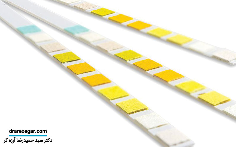 کاربرد تست نوار مثانه