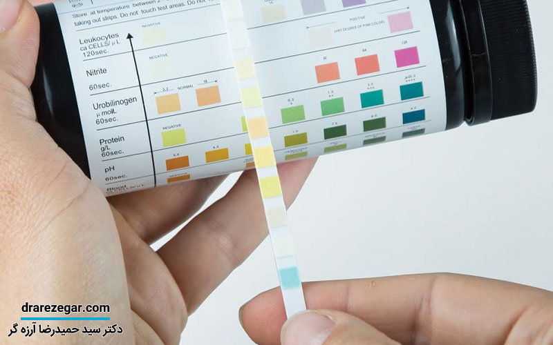 کاربرد تست نوار مثانه