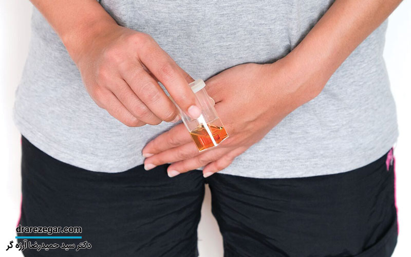 دلایل ادرار خونی در مردان