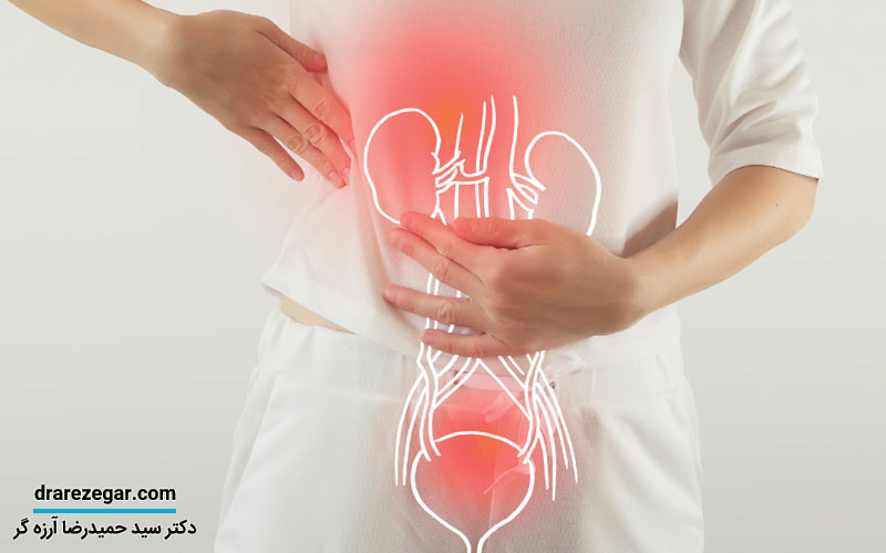 سندرم مثانه دردناک